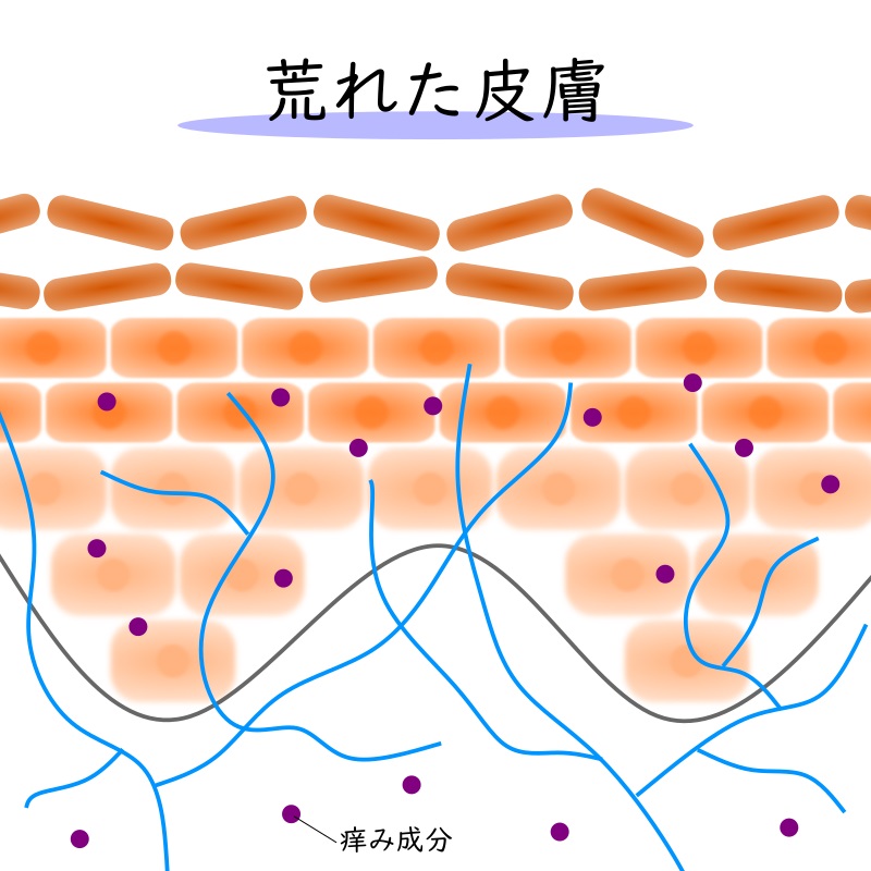 荒れた皮膚